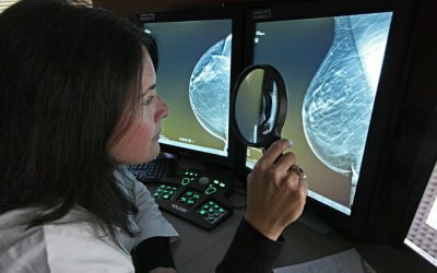 Should I Get A Mammogram Every Two Years Instead of Annually?