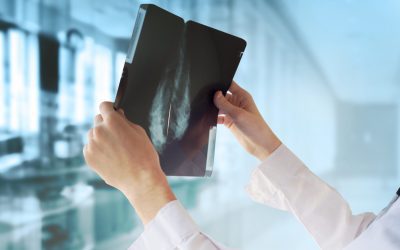 FDA Updates Mammography Regulations to Require Reporting of Breast Density Information and Enhance Facility Oversight