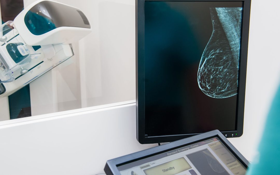 New Guidance Determines COVID Vaccines Should Not Delay Mammogram Screenings