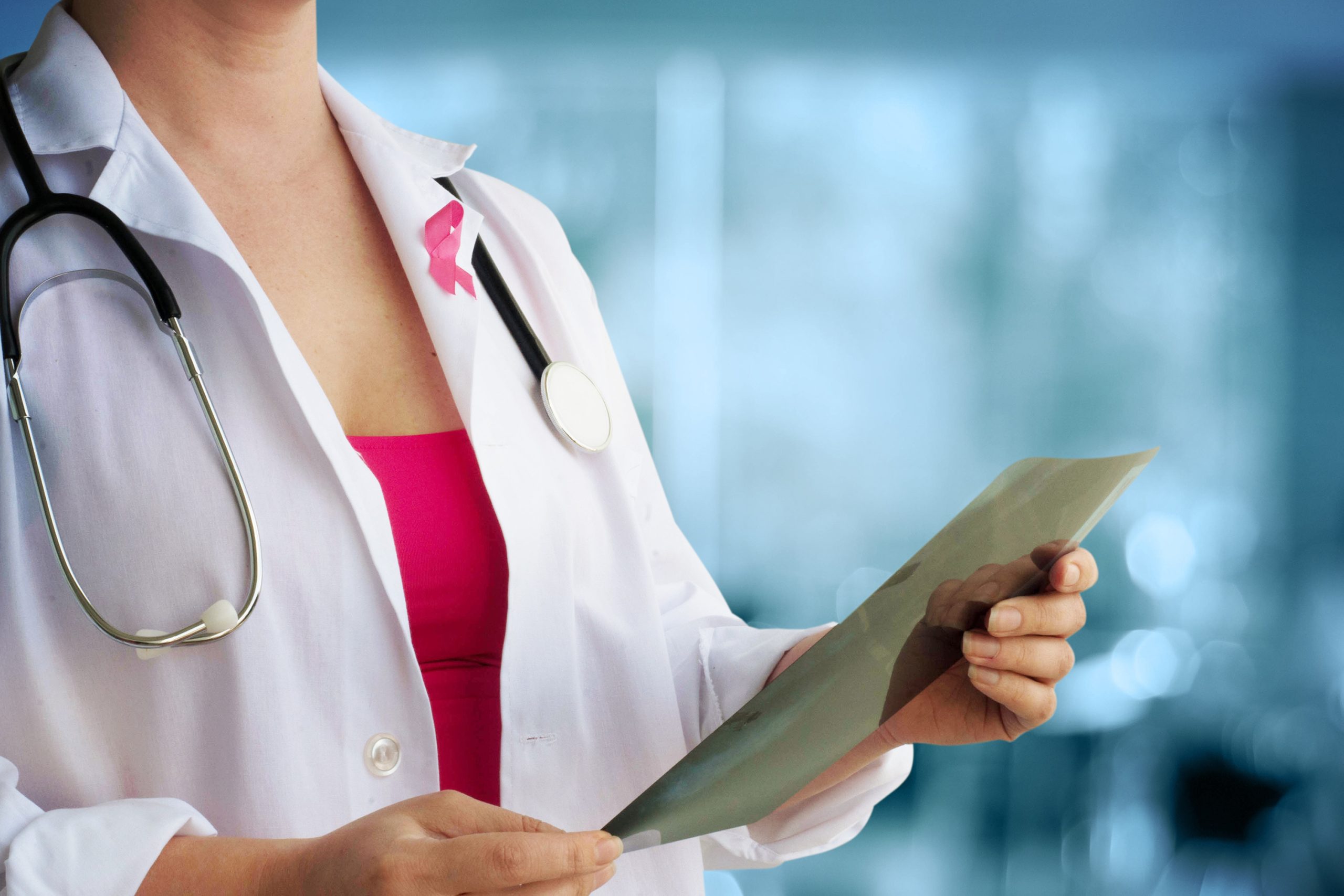 Doctor holding a mammogram